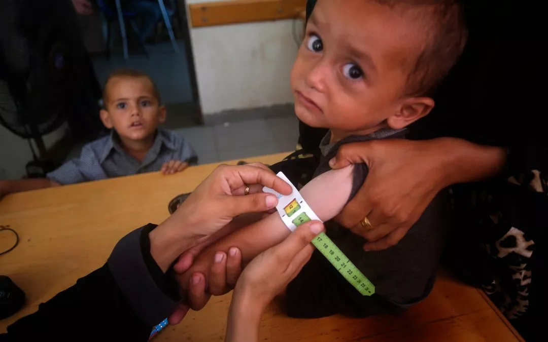 Hambre masiva en Gaza: ni el personal humanitario se salva